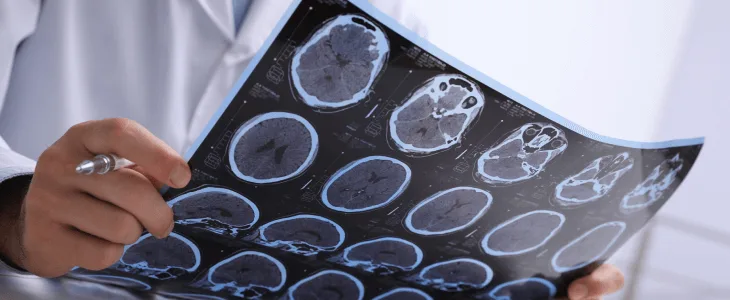Doctor with brain scans