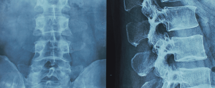 Spinal cord x-ray from the hospital