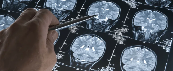 Doctor analyzing brain scans