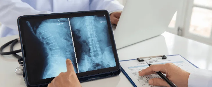 Doctor pointing to a scan of the spinal cord injury